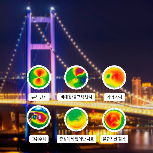 야경 현수교 위 각막 지형도 6개 — 규칙 난시·비대칭/불규칙 난시·각막 상처·고위수차·중심에서 벗어난 치료·불규칙한 절삭(일반 시력교정 후 시야)